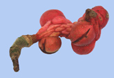 fruit du magnolia x soulangeana